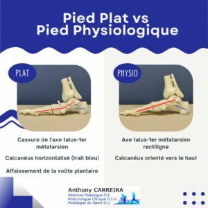 semelle orthopédique et pied plat - comparaison pied plat - pied physiologique - Anthony CARREIRA